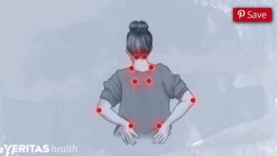 فيبروميالجيا: داء الآلام المزمنة.. أحدث توصيات التشخيص والعلاج والتعايش مع المرض..