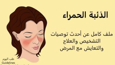 الذئبة الحمراء: ملف كامل عن أحدث توصيات التشخيص والعلاج والتعايش مع المرض..