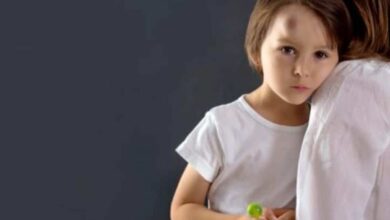 إصابات الرأس في الأطفال.. ما هو التصرف الصحيح؟
