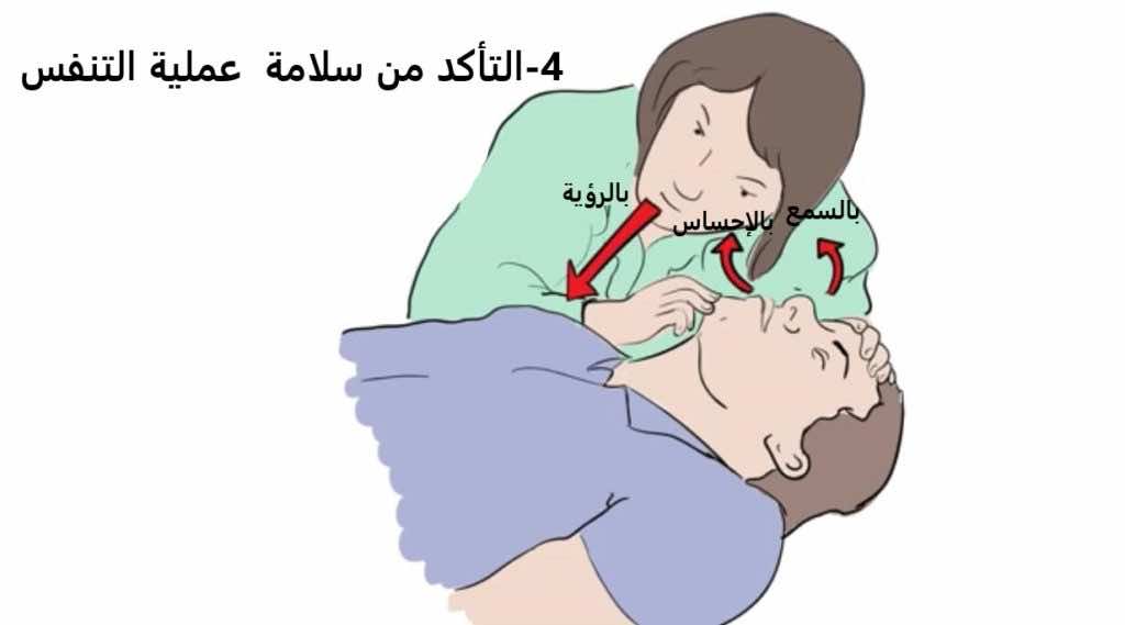 خطوات"الإنعاش القلبي الرئوي باليدين وحدهما" (Hands only CPR). صورة رقم 4