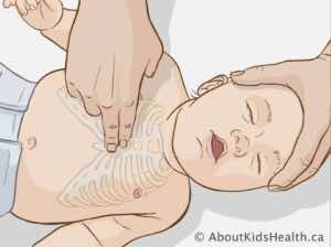 الضغطات الصدرية في طفل عمره أقل من عام