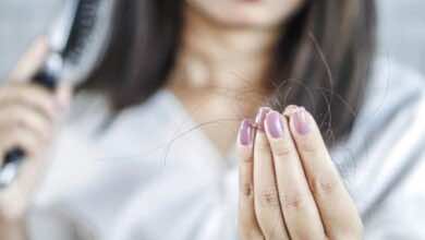 تساقط الشعر النسائي الوراثي :ملف كامل عن أحدث توصيات التشخيص والعلاج