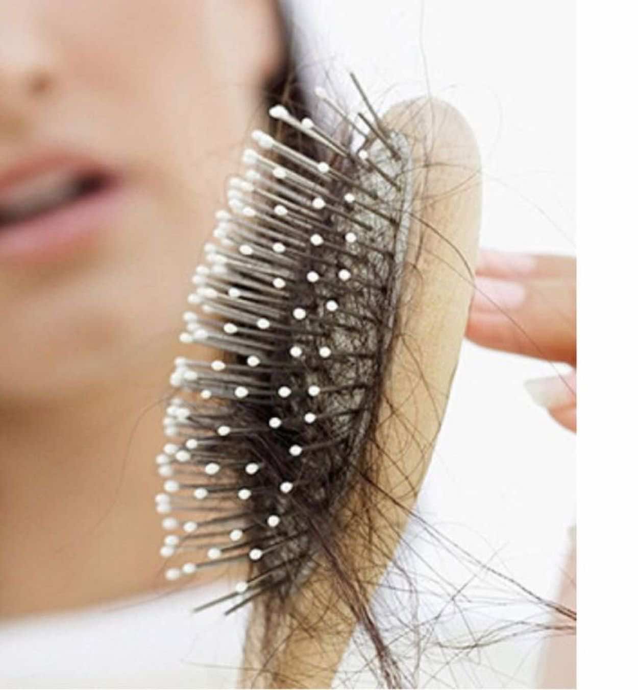3 أنواع لتساقط الشعر بسبب التوتر كيف تحدث وما هو الحل طب اليوم