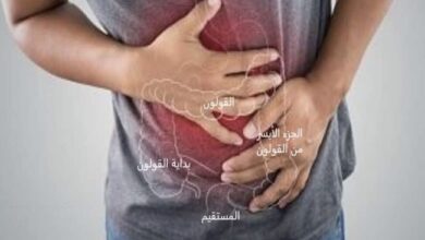 يؤثر التهاب القولون التقرحي في القولون (الأمعاء الغليظة)، وأكثر الأماكن إصابة هو الجزء الأيسر من القولون أو الجزء الأخير (المستقيم)