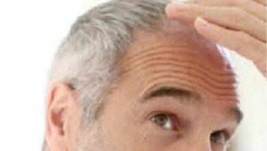 هل يرتبط ظهور الشعر الأبيض مبكرا باحتمالات أكبر لأمراض القلب؟