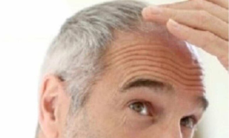 هل يرتبط ظهور الشعر الأبيض مبكرا باحتمالات أكبر لأمراض القلب؟