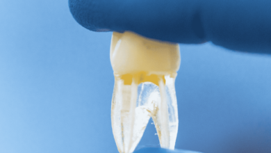 فيزيتا مجانية | 6 عادات خاطئة قد تدمر أسنانك بحسب خبراء طب الاسنان