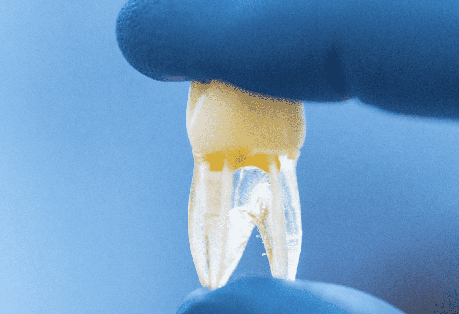 فيزيتا مجانية | 6 عادات خاطئة قد تدمر أسنانك بحسب خبراء طب الاسنان