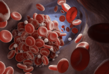 تحليل دي دايمر هل يؤكد وجود الجلطة الدموية؟ و هل نعتمد عليه لتناول مضادات التجلط؟