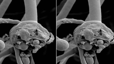  الفطر الاسود | 4 نصائح تقلل التعرض لميكروب الفطر الاسود - ما هو علاج العفن الاسود؟ - كوفيد-19