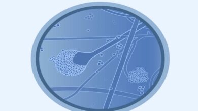 نقص علاج العفن الاسود في الهند وسط ظهور حالات جديدة مصاحبة لعدوى كوفيد-19