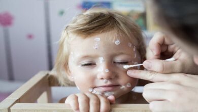 علاج الجديري المائي عند الاطفال | 8 نصائح وتحذيرات هامة