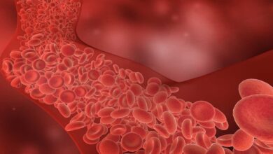 علاج جلطات الدم بعد تلقي اللقاح | 8 أنواع من مضادات التجلط ليس منها هيبارين أو اسبرين