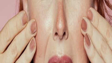 علاج حروق الشمس للوجه والبشرة في المنزل | 9 نصائح وتحذيرات