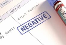 4 من سوائل الجسم لا تنقل فيروس نقص المناعة (الايدز).. فما هي؟