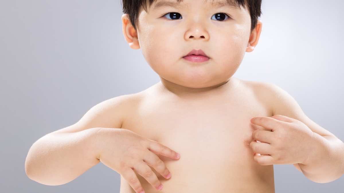 طفح جلدي عند الاطفال مع حكة | 7 اسباب رئيسية  (بالصور)
