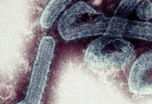 غينيا تتابع 155 شخص اختلطوا بمريض فيروس ماربورغ القاتل