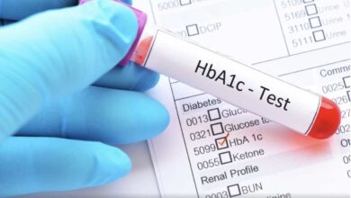 ما هو تحليل السكر التراكمي؟ وما دوره في تشخيص وعلاج السكري؟