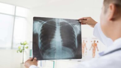 بريطانيا تبدأ تقديم دواء جديد ناجح لمرضى سرطان الرئة