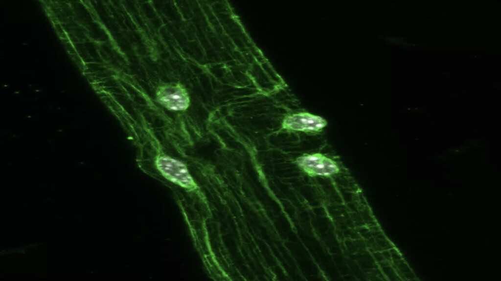 أنوية الخلايا تتجمع في مناطق التمزق