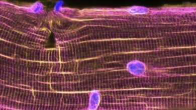 أنوية الخلايا (باللون البنفسجي) تتجمع في مناطق التمزق