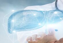 ما هي نسب نجاح عملية زراعة الكبد في الهند، بريطانيا، مصر، امريكا؟