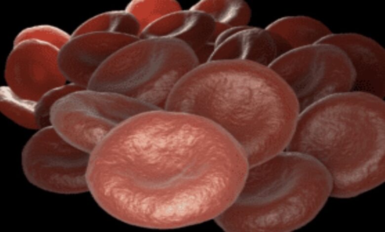  انيميا نقص الحديد | أهم 4 أسباب وكيف يتم التشخيص؟ - فقر الدم