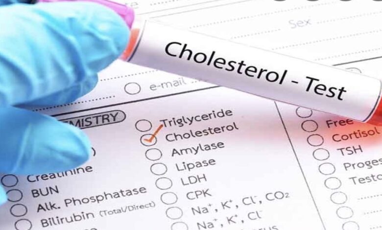 ما هي اعراض ارتفاع الكوليستيرول؟ ومتى يجب أن تجرى تحليل الكوليستيرول؟