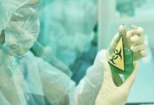 الصحة العالمية توصي اوكرانيا بتدمير الميكروبات الخطيرة في معاملها