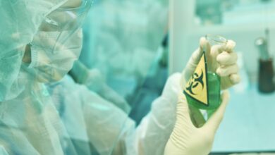 الصحة العالمية توصي اوكرانيا بتدمير الميكروبات الخطيرة في معاملها