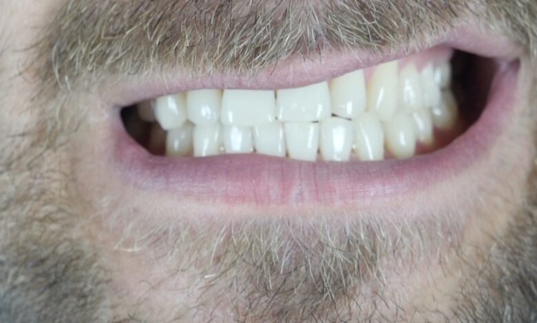 علاج صرير الاسنان | 5 خيارات علاجية منها واقي الاسنان الليلي