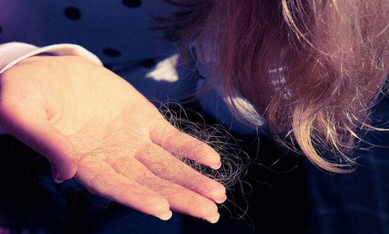 علاج تساقط الشعر النسائي الوراثي | 3 خيارات علاجية