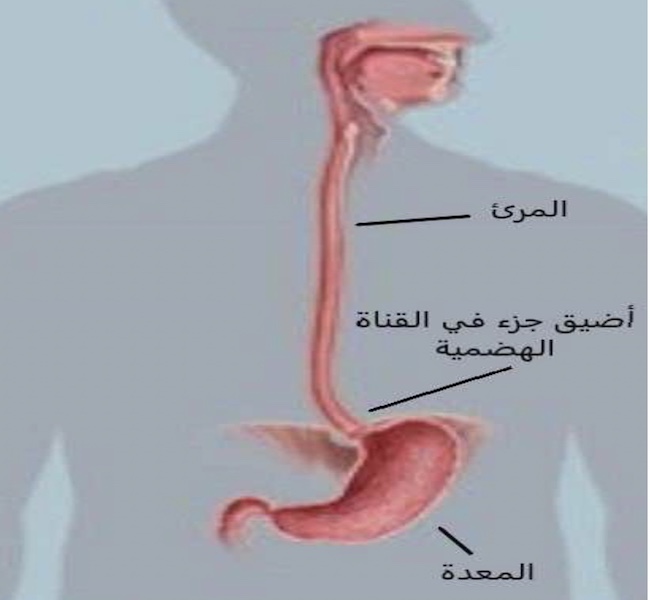 أضيق جزء في القناة الهضمية medicinenet