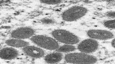 الصحة العالمية: انتشار جدري القرود محدود ويمكن السيطرة عليه رغم تزايد الاعداد