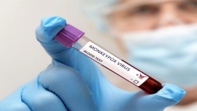 جدري القرود قد يكون قاتلا لاصحاب المناعة الضعيفة - دراسة