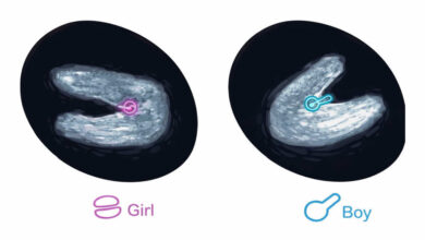 معرفة نوع الجنين ب السونار اثناء الحمل بالصور .. ولد ولا بنت؟